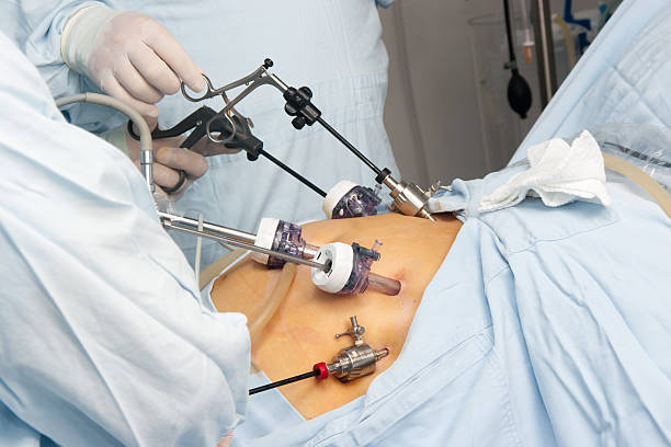 Laparoscopy Surgery