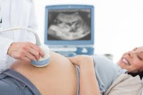 Doppler Ultrasound Sonography