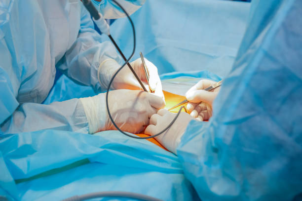 Total Laparoscopic Hysterectomy (TLH)