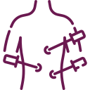 Diagnostic Laparoscopy